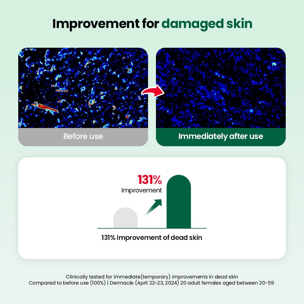 Dr.G R.E.D Blemish Clear Double Soft Pads 60 Renewal