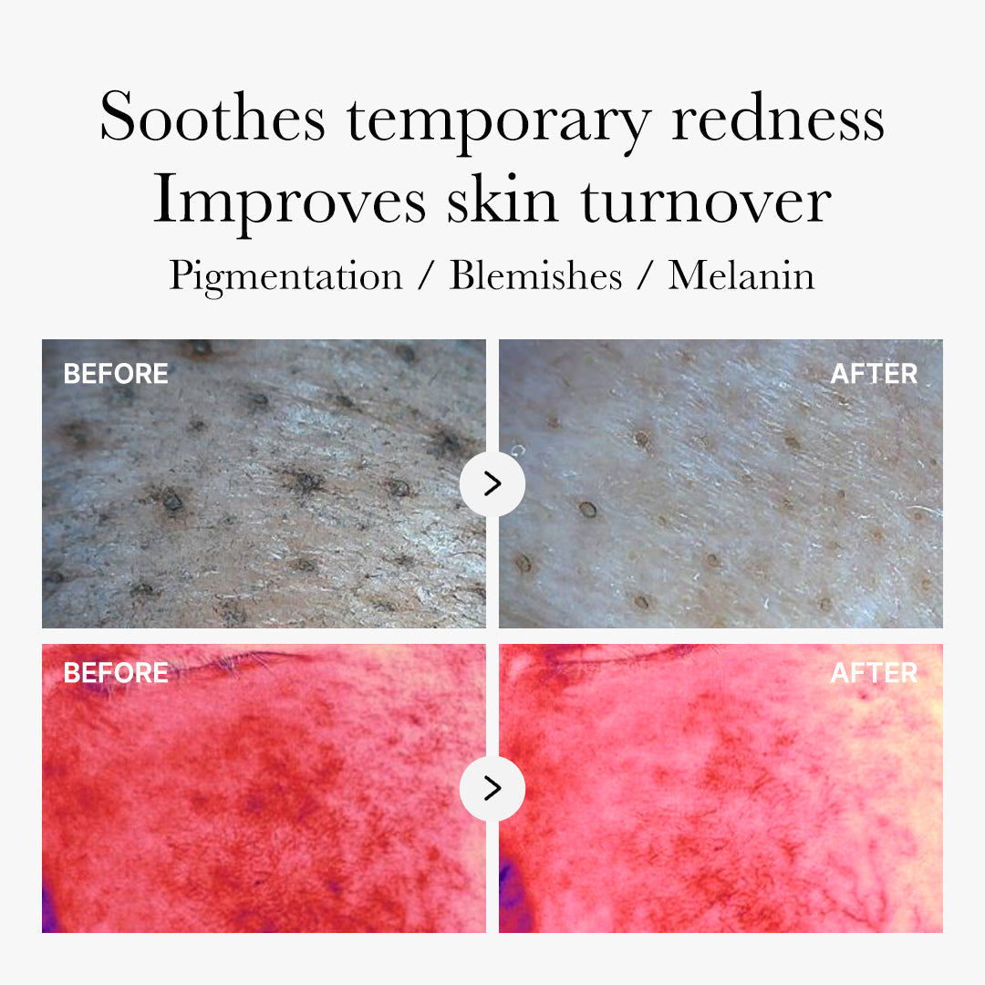 Medicube Red Succinic Acid Peeling Pad