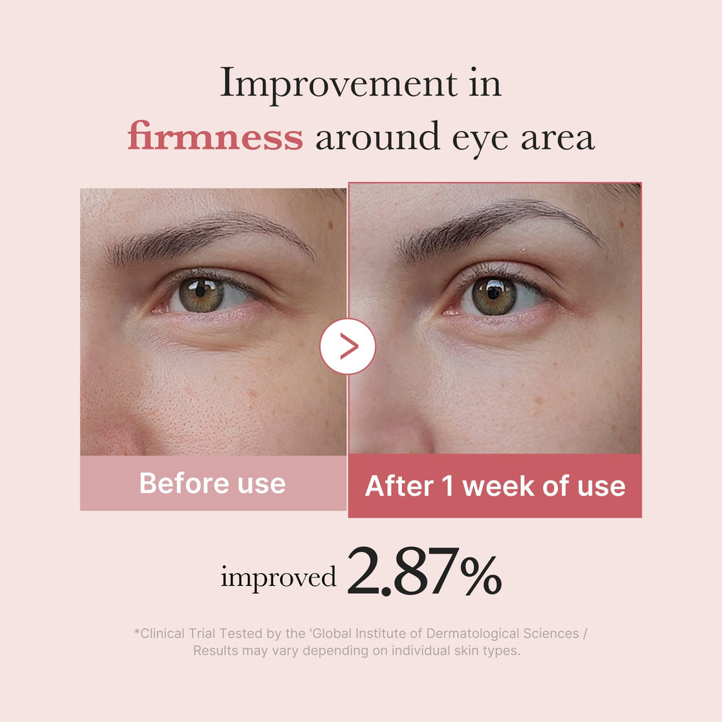 Medicube PDRN Pink Peptide Eye Serum 30ml