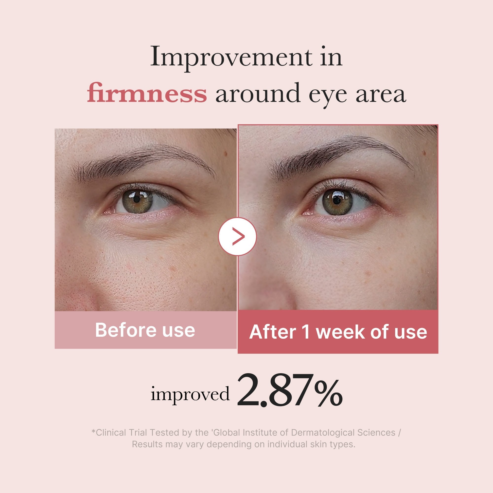Medicube PDRN Pink Peptide Eye Serum 30ml