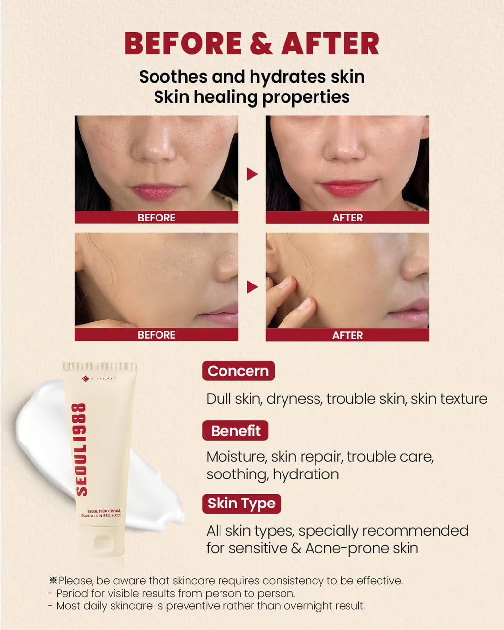 K-Secret Seoul 1988 Cream : Snail Mucin 93% + Rice 100ml
