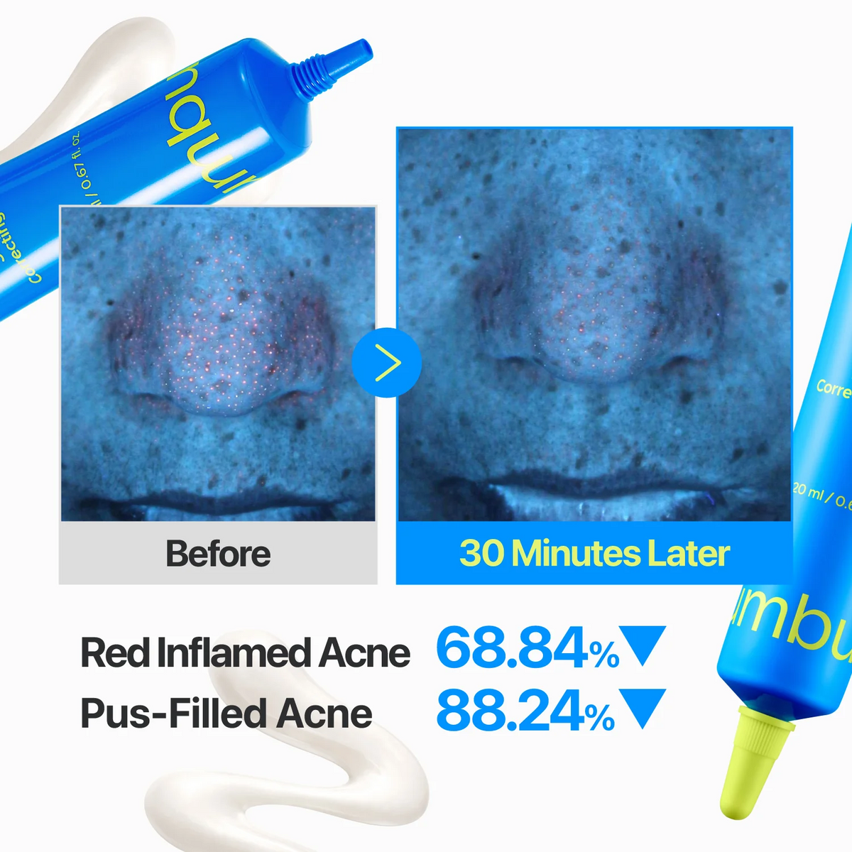 Numbuzin No.1 Zero Blemish 3X Spot Correcting Cream 20ml