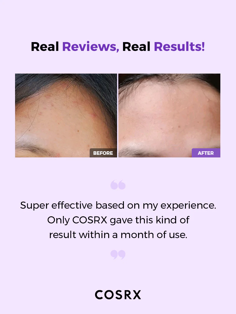 Cosrx AHA/BHA Clarifying  Treatment Toner