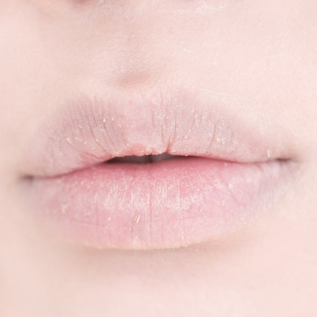 Laka Soothing Prep Lip Mask 10ml